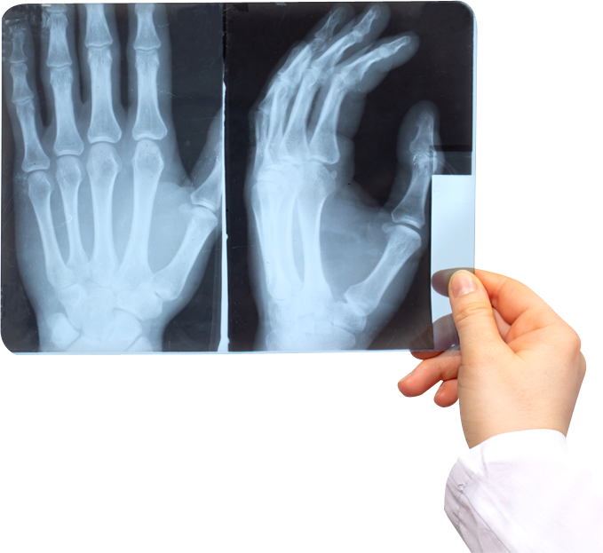 Hand X-ray Picture